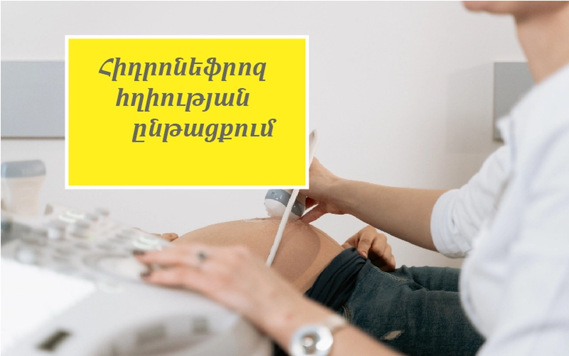 Հիդրոնեֆրոզ հղիության ընթացքում