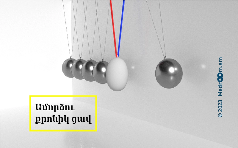 Ամորձու քրոնիկ ցավ